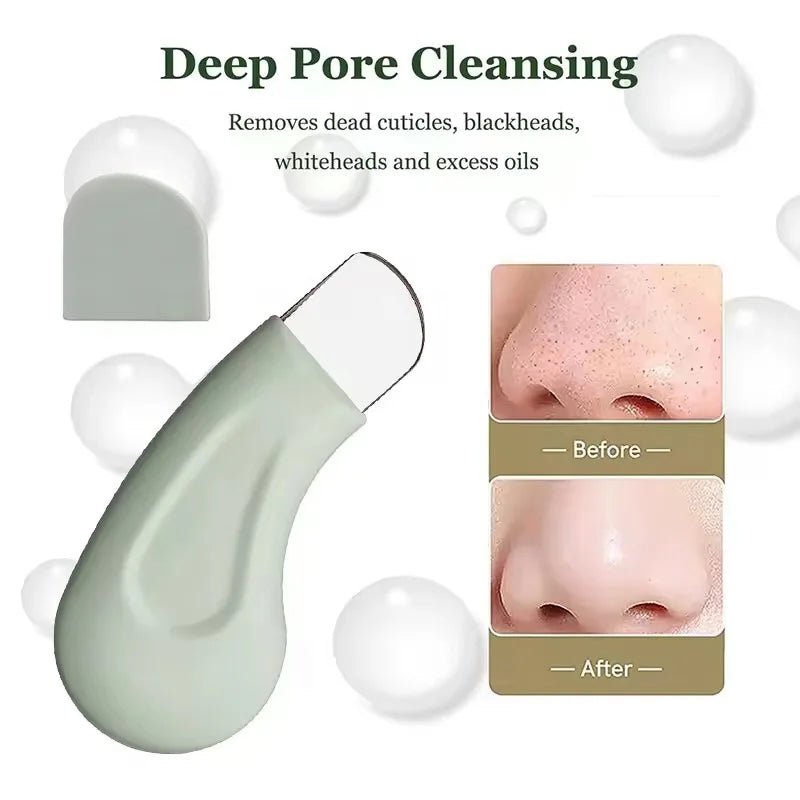 Blackhead and Whitehead Removal Tool for Nose and Face - Skin Pore Cleaner Skin Care Tools for Women - memorylane shop