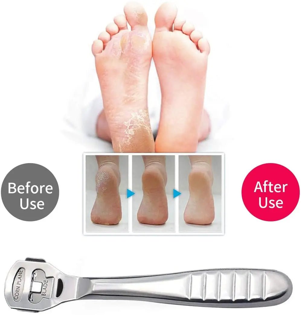 Foot Callus Shaver Heel Hard Skin Remover Hand Feet Pedicure Razor Tool Shavers Stainless Steel Handle 10 Blades Foot Care Tools - memorylane shop