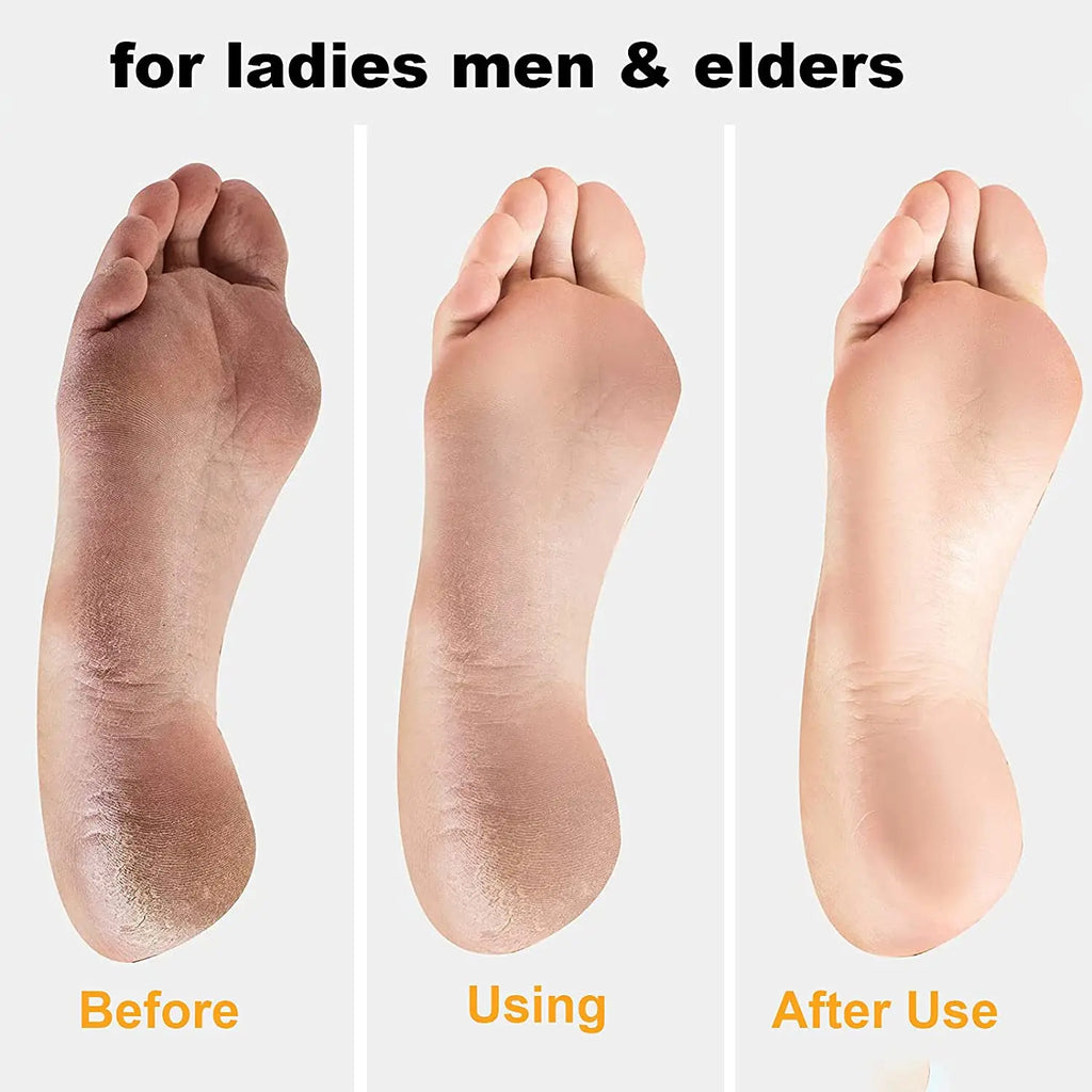 Pedicure Tools Heel Scratcher Files Artifact Exfoliating Calluses Brush Stainless Steel Foot Sharpening Double - sided Pedicura - memorylane shop
