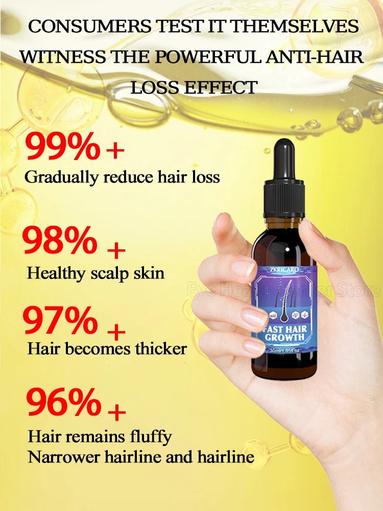 ZKRICARO 0fficial genuine, high quality hair growth essence 0il, scalp care, make hair grow thicker, no more baIIdness - memorylane shop