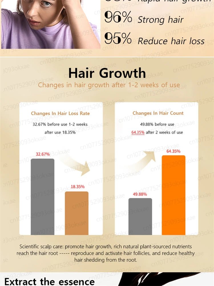 ZKRICARO 0fficial genuine, high quality hair growth essence 0il, scalp care, make hair grow thicker, no more baIIdness - memorylane shop