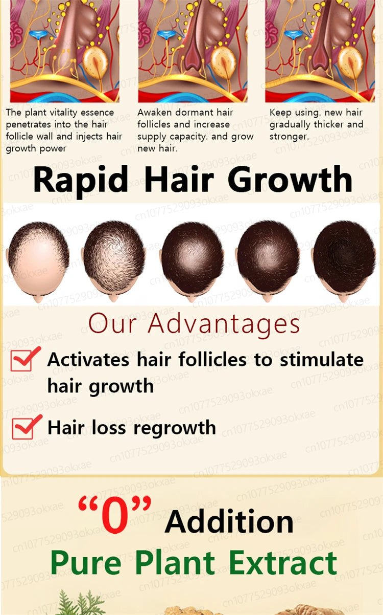 ZKRICARO 0fficial genuine, high quality hair growth essence 0il, scalp care, make hair grow thicker, no more baIIdness - memorylane shop
