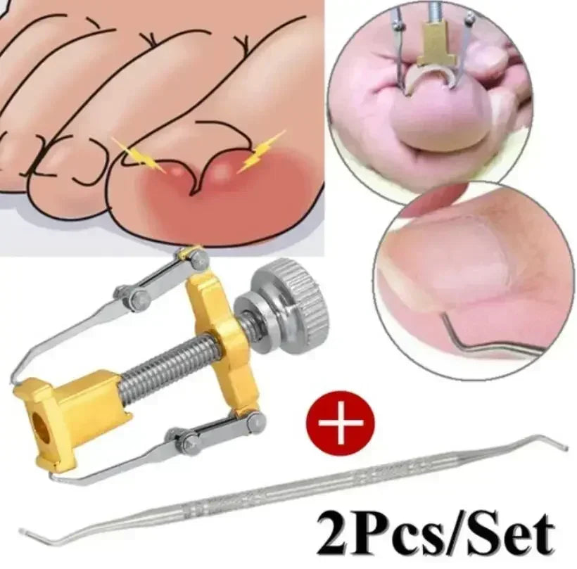 Foot Care Tools - Pedicure Dead Skin and Callus Remover, Foot Scrubber with Sandpaper and Wooden Handle