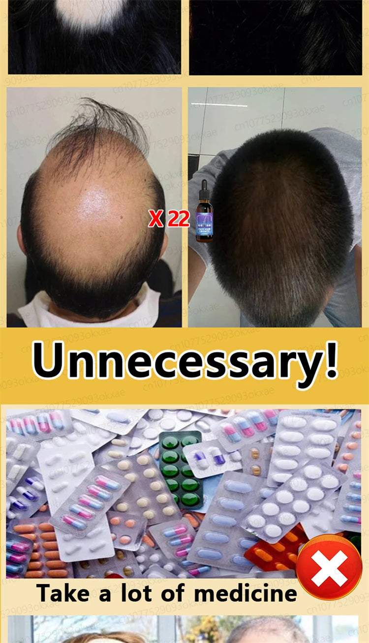 ZKRICARO 0fficial genuine, high quality hair growth essence 0il, scalp care, make hair grow thicker, no more baIIdness