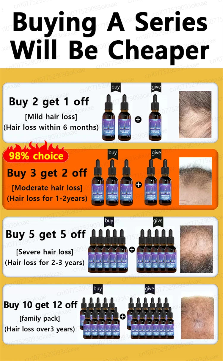 ZKRICARO 0fficial genuine, high quality hair growth essence 0il, scalp care, make hair grow thicker, no more baIIdness