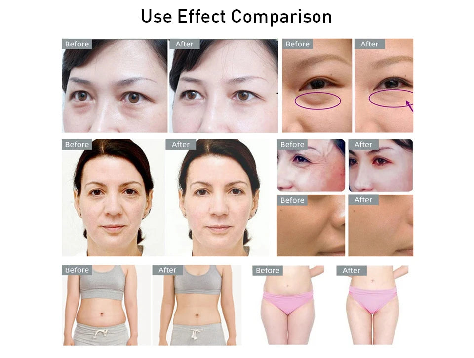 40K 3-in-1 Ultrasonic Body Shaping Instrument Negative Pressure Slimming Beauty Massage  Facial Care Beauty Salon Dedicated