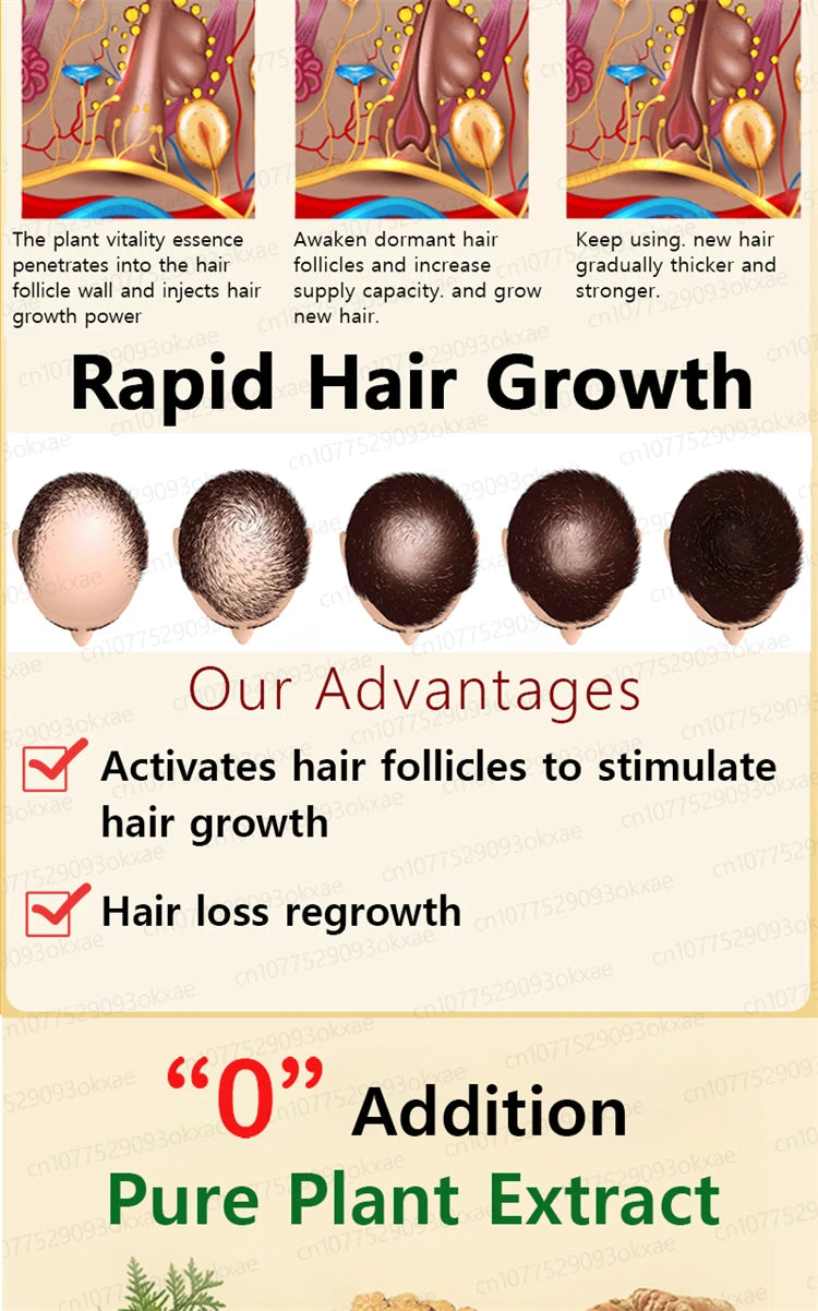 ZKRICARO 0fficial genuine, high quality hair growth essence 0il, scalp care, make hair grow thicker, no more baIIdness
