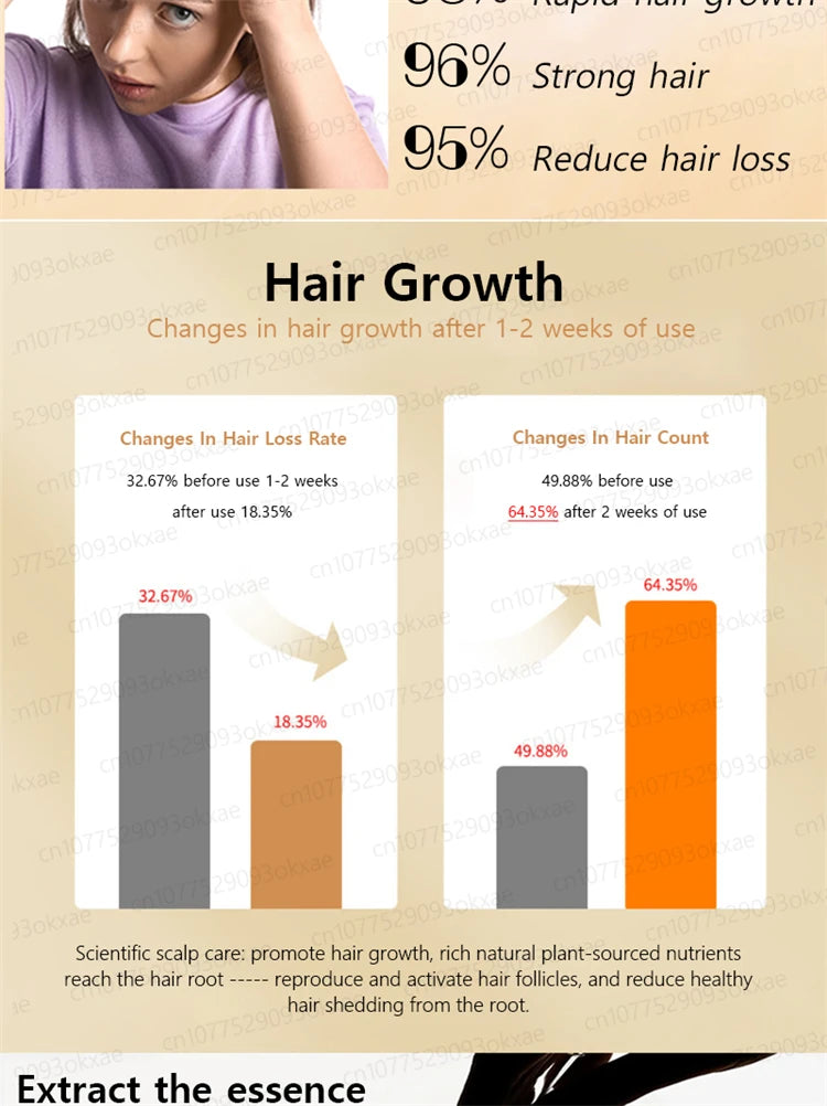 ZKRICARO 0fficial genuine, high quality hair growth essence 0il, scalp care, make hair grow thicker, no more baIIdness