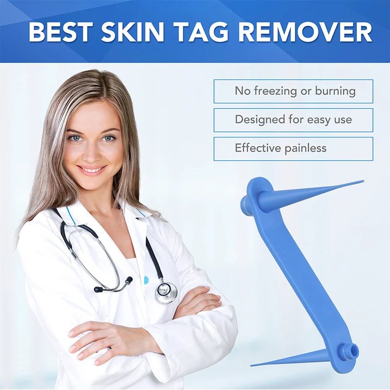 Simple Wart Removal Tool Set Skin Tag Removeal Tool Easy To Clean Skin Care Tool Skin Tag Removal Care Products - memorylane shop