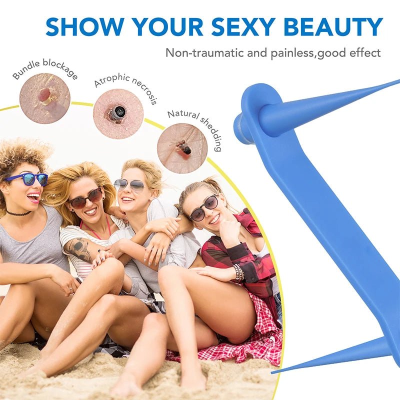 Simple Wart Removal Tool Set Skin Tag Removeal Tool Easy To Clean Skin Care Tool Skin Tag Removal Care Products - memorylane shop