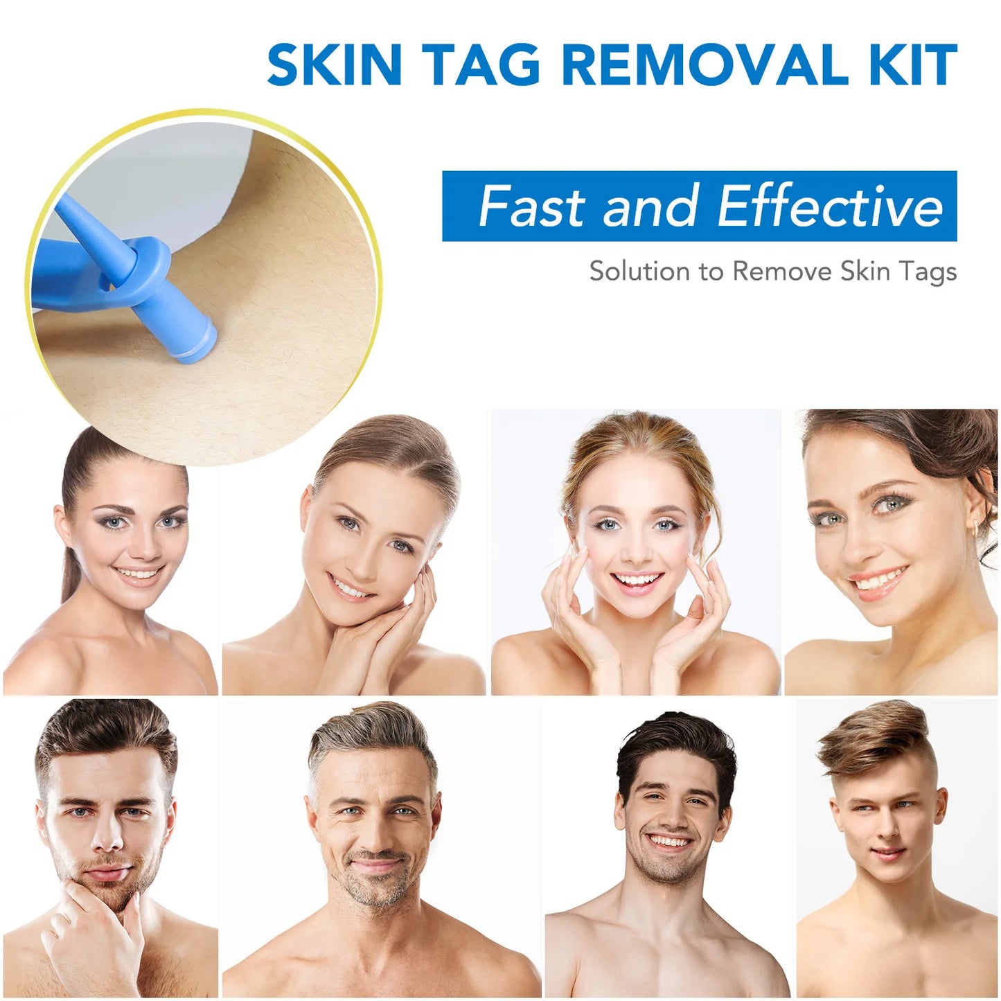 Simple Wart Removal Tool Set Skin Tag Removeal Tool Easy To Clean Skin Care Tool Skin Tag Removal Care Products - memorylane shop