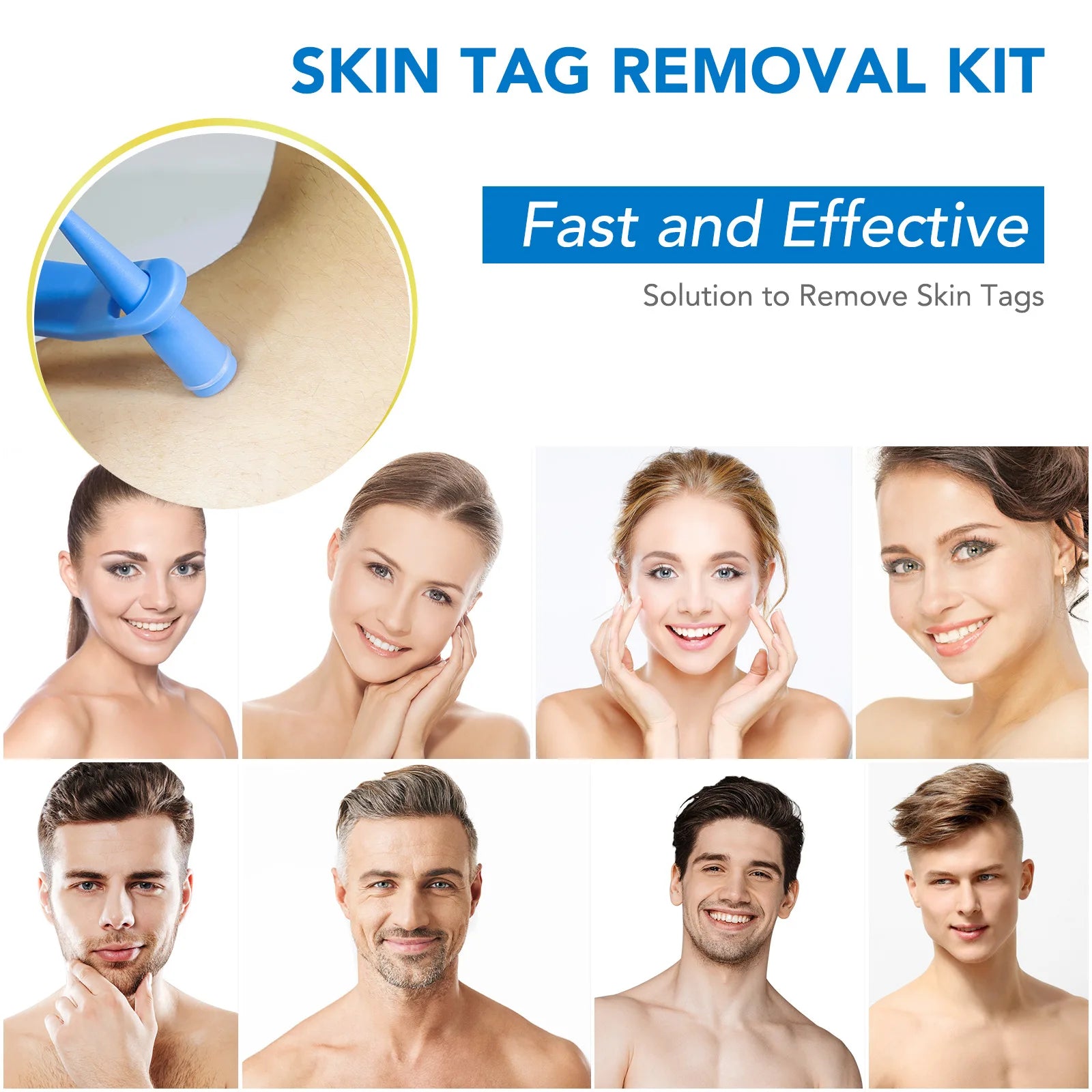 Simple Wart Removal Tool Set Skin Tag Removeal Tool Easy To Clean Skin Care Tool Skin Tag Removal Care Products - memorylane shop