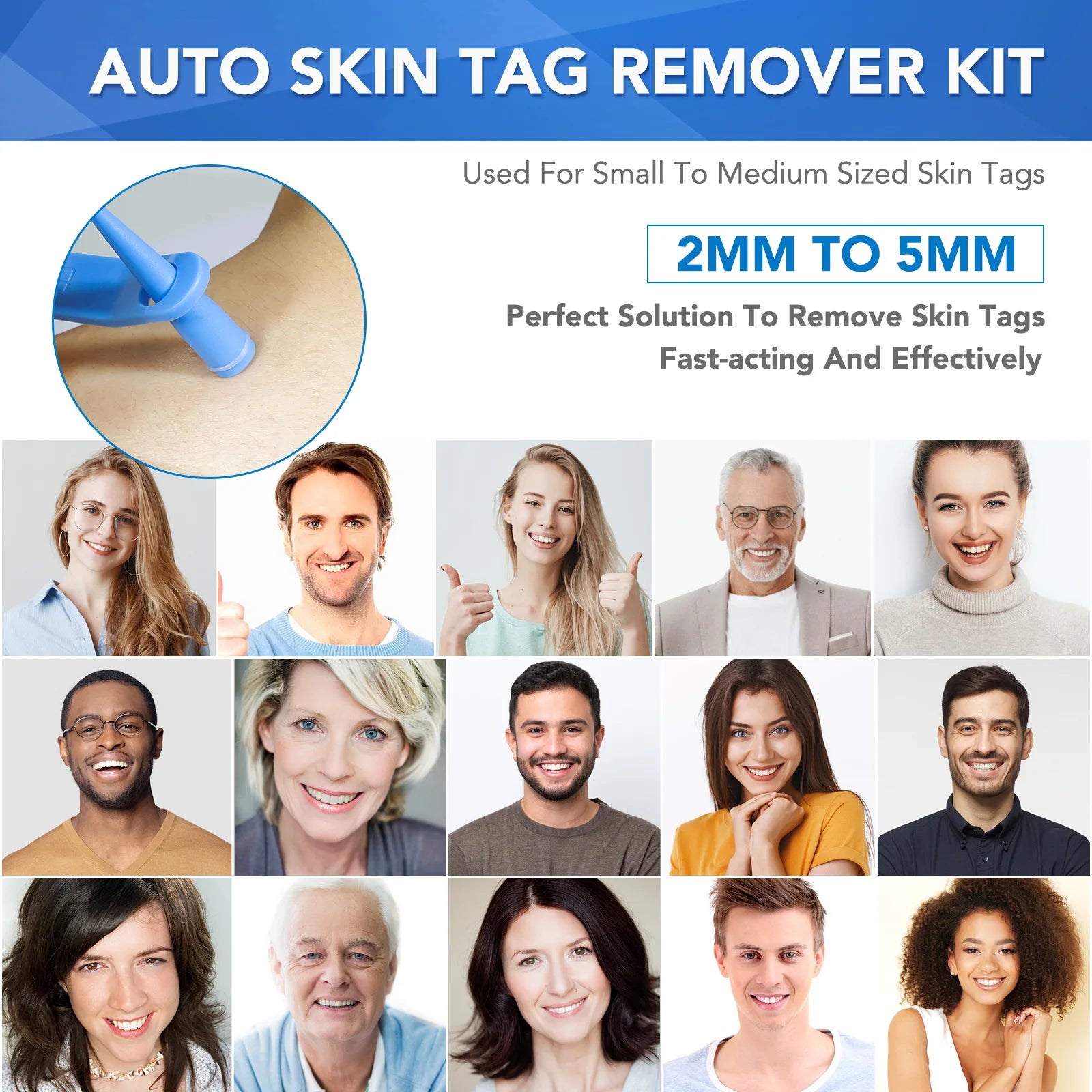 Simple Wart Removal Tool Set Skin Tag Removeal Tool Easy To Clean Skin Care Tool Skin Tag Removal Care Products - memorylane shop